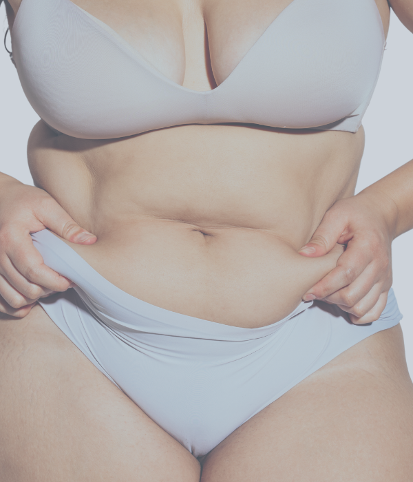 Bauch vor der Fettabsaugung.