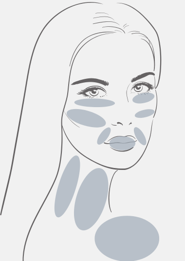 Behandlungsbereiche Hyaluronsäure Gesicht.